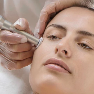 Micro Channeling Facial